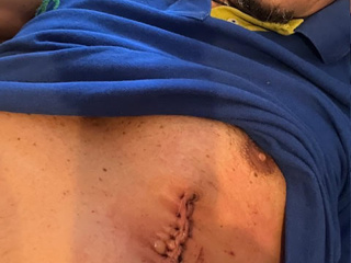 Manetti went under surgery and left the hospital one week before the race